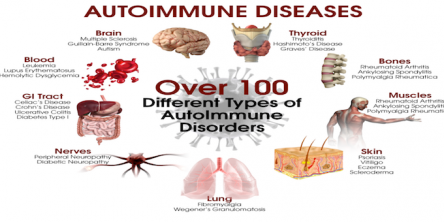  Autoimmune Diseases